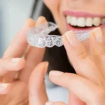 Invisalign